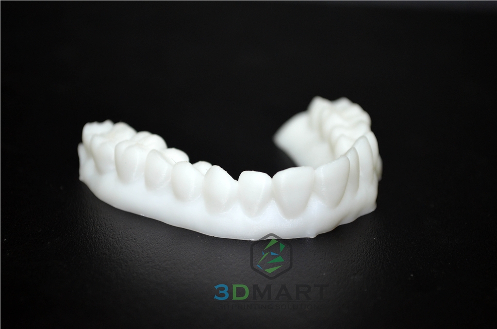 3D列印，牙齒，齒模，HIPS, ULTIMAKER2