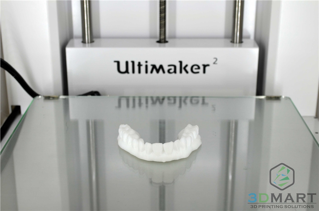3D列印，牙齒，齒模，HIPS,