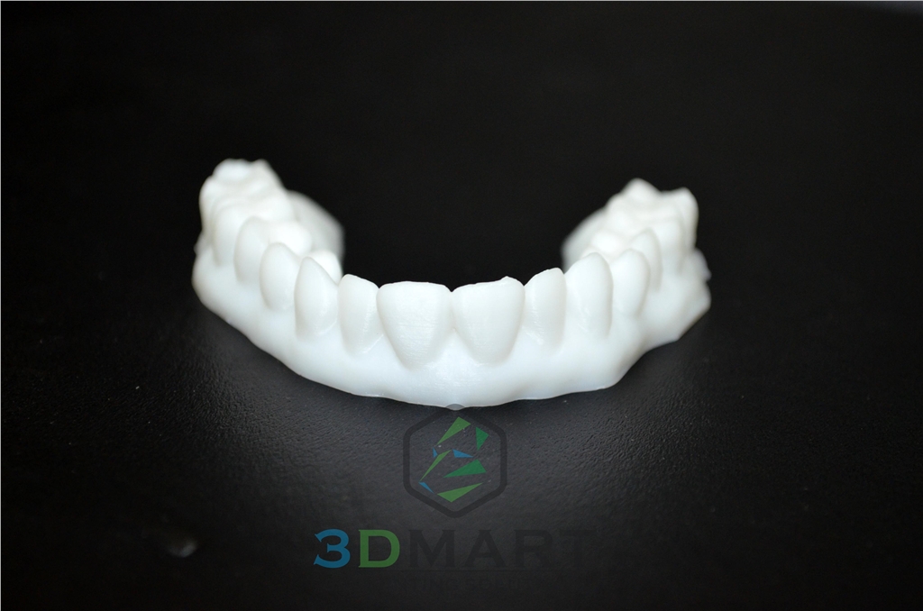 3D列印，牙齒，齒模，HIPS, ULTIMAKER2