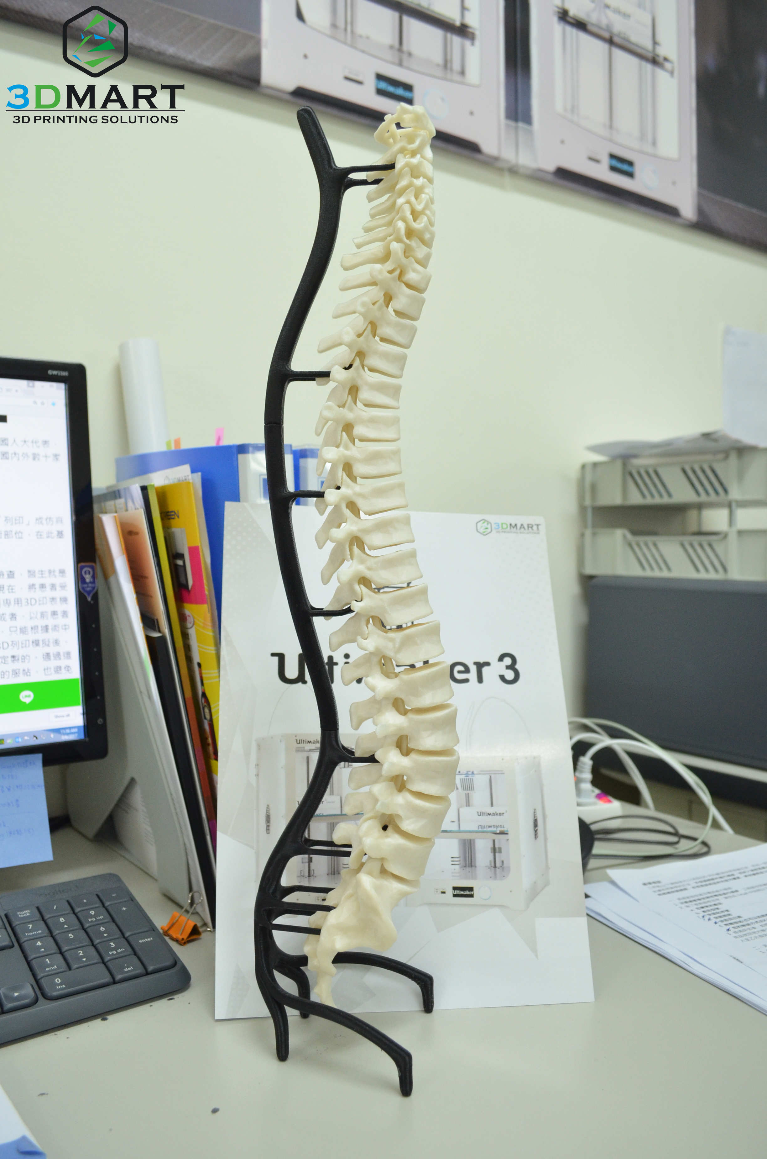 Ultimaker 3D列印機能夠醫療設備 Ultimaker 3D列印機能夠醫療設備